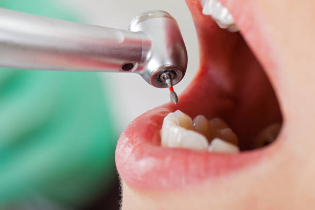 Best Broken or Cracked Tooth Emergency Dentist in Kankakee, IL